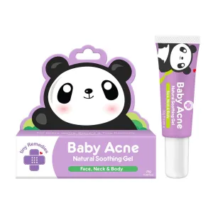 Tiny Buds Baby Acne Soothing Gel 20g
