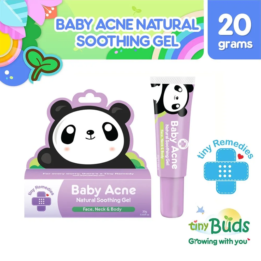 Tiny Buds Baby Acne Soothing Gel 20g
