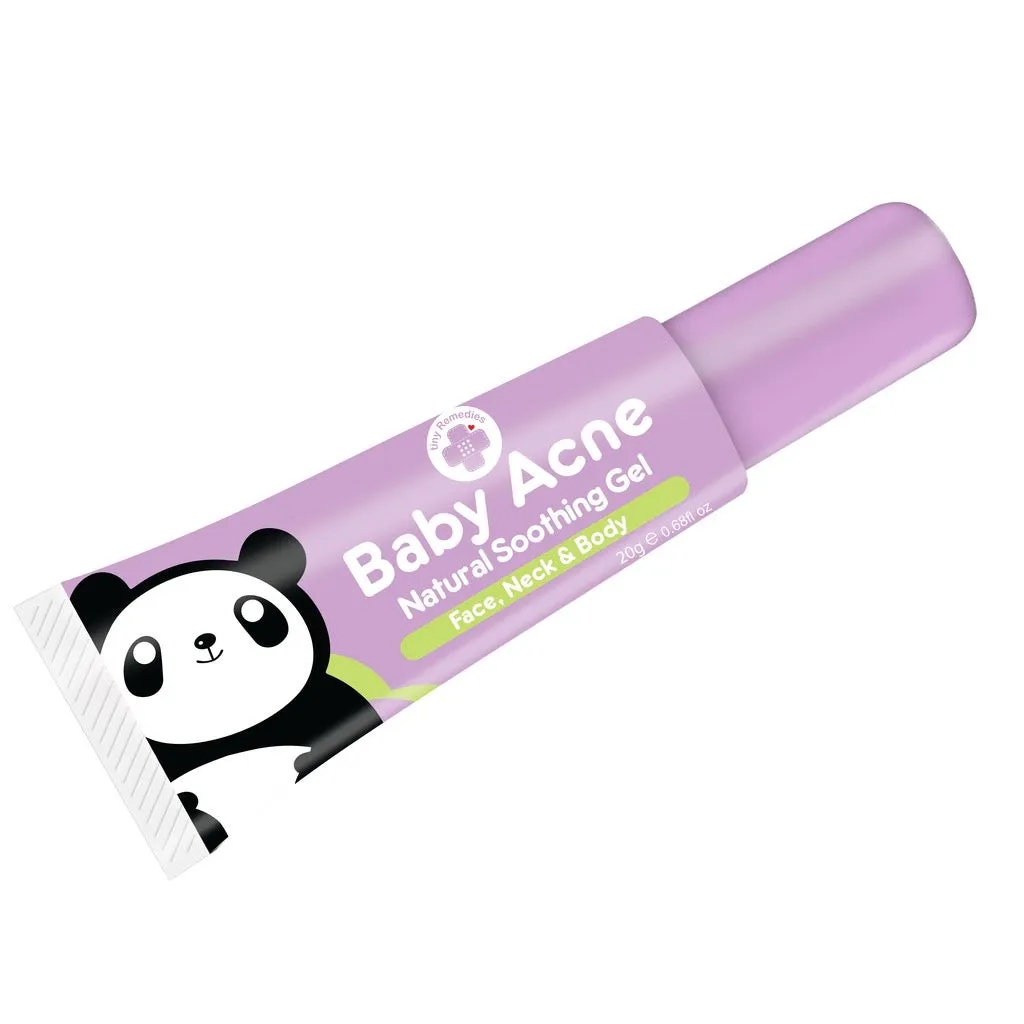 Tiny Buds Baby Acne Soothing Gel 20g