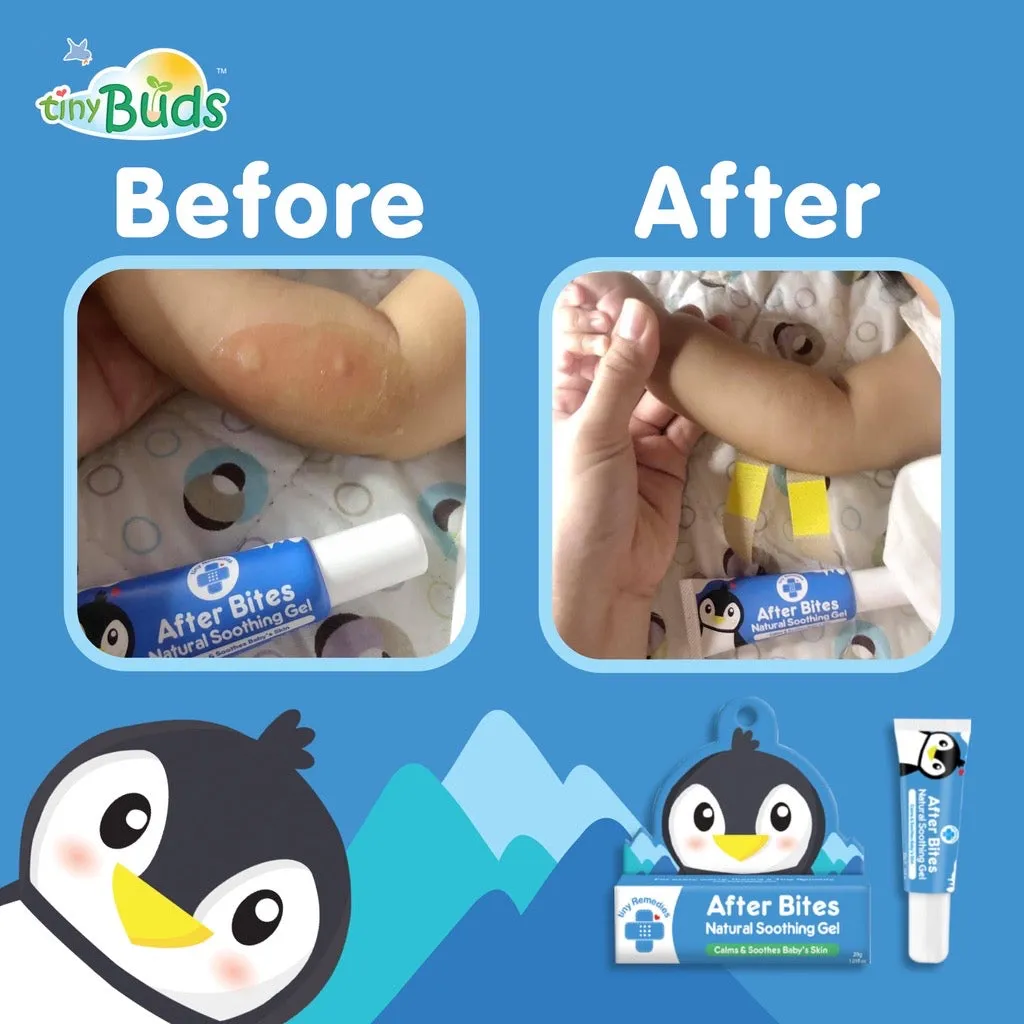 Tiny Remedies After Bites Natural Soothing Gel 20g